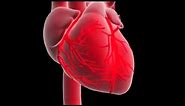 What is a myocardial infarction or heart attack ?