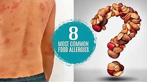 What are the 8 Most Common Food Allergies? Symptoms, Treatment & Testing