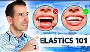 Ultimate Guide to Rubber bands | Braces Elastics