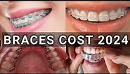 Braces Type & Treatment Cost 2024 | Metal vs Ceramic vs Lingual vs Invisalign Braces | Latest