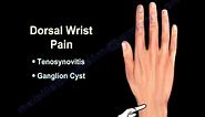 WRIST PAIN COMMON CAUSES - Everything You Need To Know - Dr. Nabil Ebraheim