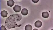 White Blood Cell Chases Bacteria