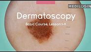 Dermoscopy (Dermoscopy Basics) | MEDILOGIN