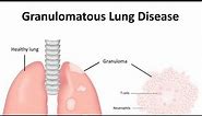 Granulomatous diseases of Lung |Introduction