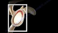 SLAP Tear Overview - Everything You Need To Know - Dr. Nabil Ebraheim