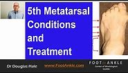 5th Metatarsal Conditions | Seattle Podiatrist