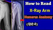How to read X-Ray Arm || Xray Humerus Anatomy || UdayXray