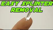 Awesome Splinter Remover - Splinter Out Review and Demo