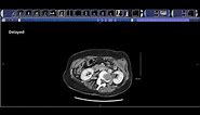 How to read a pancreas CT
