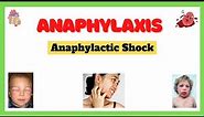 Anaphylactic Shock (Anaphylaxis)| Signs and Symptoms, Causes, Complications, Treatment| Made Easy