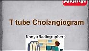 T tube cholangiogram | Radiology Procedure