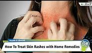 How To Treat Skin Rashes with Home Remedies | ISH News