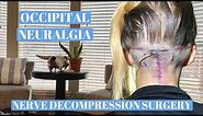 Occipital neuralgia Nerve decompression surgery recovery