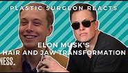Elon Musk's Transformation: Plastic Surgeon Reacts to The Founder of Tesla