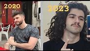 Hair growth time-lapse - 3 years