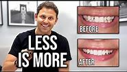 Less is More (Peg Laterals) - Dental Science