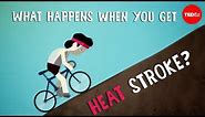 What happens when you get heat stroke? - Douglas J. Casa