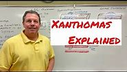 Xanthoma, A Simple Explanation