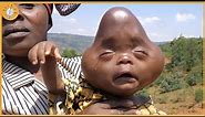 15 Babies That Look Like Aliens | Extraordinary People