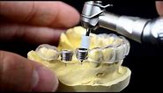 Dental implant surgical guide drilling protocol