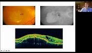 Retinal OCT for Clinicians