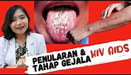 #HIVAIDS 1 | Penularan dan Tahap Gejala HIV AIDS | dr. Ema Surya P