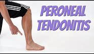 Peroneal Tendonitis (Side of Foot Pain), Causes & Self-Treatment.