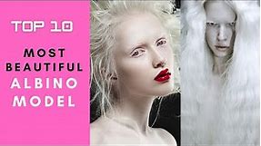 10 Female Model With Albinism