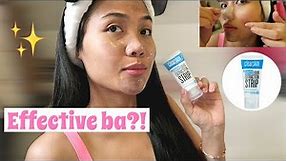 EFFECTIVE NGA BA?! AVON CLEARSKIN BLACKHEAD CLEARING LIQUID EXTRACTION STRIP REVIEW