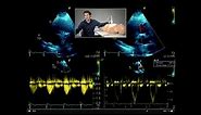 How to perform a full, comprehensive transthoracic echo study