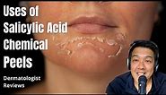 Salicylic Acid Peels | Indications