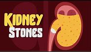 Kidney Pain? How to treat Kidney Stones? Causes and Symptoms