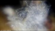 Woolly Apple Aphids - Eriosoma lanigerum - Macro HD