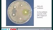 Microbiology resources - How to Measure Zones of Inhibition (ZOI)