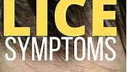 17 Lice Symptoms with Pictures: Signs That You Have Head Lice - My Lice Advice