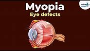 Eye defects - Myopia | Don't Memorise