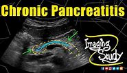 Chronic Pancreatitis || Ultrasound || Case 168