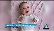 2022 Gerber baby contest winner shines spotlight on limb differences l ABC7