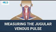 Measuring the jugular venous pulse