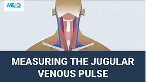 Measuring the jugular venous pulse