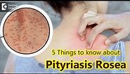5 Things to know about Pityriasis Rosea | Pityriasis Rosea Rash - Dr. Divya Sharma|Doctors' Circle