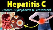 Hepatitis C – Symptoms, Causes, Pathophysiology, Diagnosis, Treatment, Complications