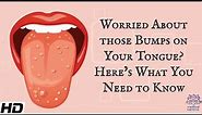 Worried About Those Bumps on Your Tongue? Here's What You Need To Know