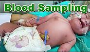Blood Sampling in Newborn / Neonate Using Butterfly Line | Arterial Blood Sample | Baby | Paediatric