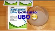 UBO? Fluimucil Alternative Acetylcysteine Granules - Exflem by Unilab (Sample Preparation)