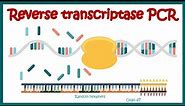 Reverse Transcriptase PCR (RT PCR) | What are the applications of RT PCR ? | RT PCR protocol