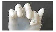 👍Realistic Robotic Hand LAD Robotic Hand V3.0 Part 3 #3dprinting #robot #prosthetic