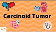 Carcinoid Tumor, Causes, Signs and Symptoms, Diagnosis and Treatment.