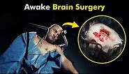 How Awake Brain Surgery is performed? | Awake Craniotomy (3D Animation)