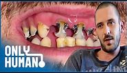 I Haven't Visited the Dentist in 10 Years | Britain's Worst Teeth | Only Human
